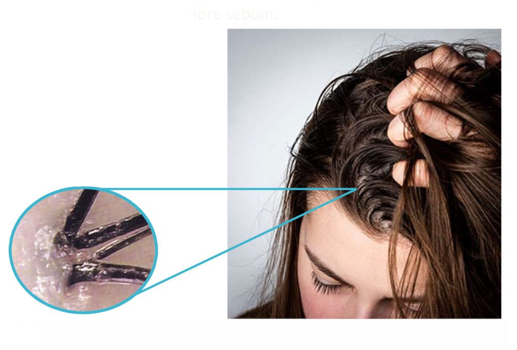 Hair Loss Prevention Program Page